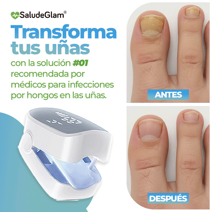 Purenail Terapia Avanzada!