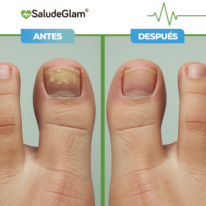 Purenail Terapia Avanzada!